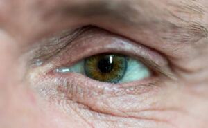 Озвучены причины мурашек перед глазами